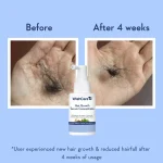WishCare Hair Growth Serum Concentrate 30 ML - Image 5