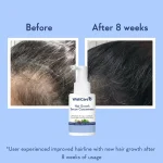 WishCare Hair Growth Serum Concentrate 30 ML - Image 6
